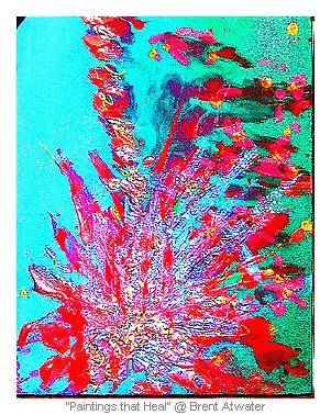 Back Pain by Brent Atwater